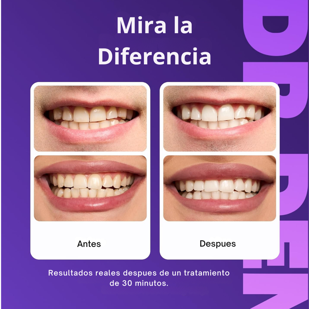 Tiras Blanqueadoras Dentales